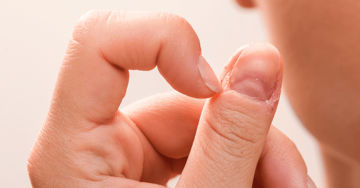 Excoriation (Skin-Picking) Disorder. excoriation disorder skin picking disorder symptoms, dermatillomania treatment, compulsive skin picking causes, excoriation disorder vs OCD, habit reversal for skin picking. Recurrent picking at one's own skin resulting in lesions and tissue damage — despite genuine and repeated attempts to stop the behavior.